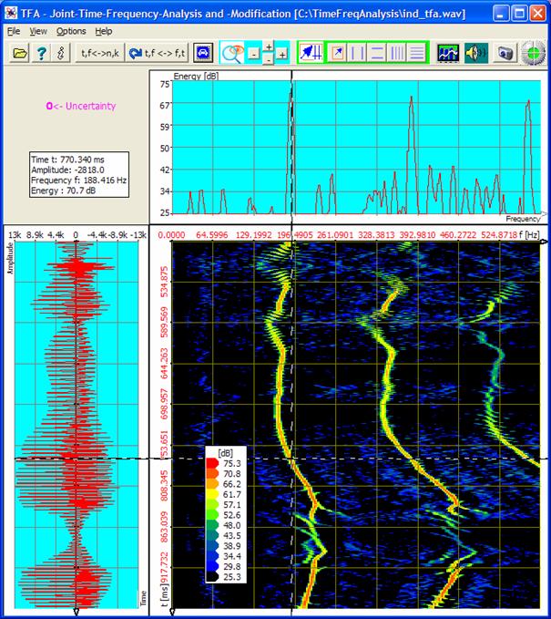 Codejock xtreme suite pro activex v16 cracked rib in shoulder Codejock xtreme suite pro activex v16 cracked rib in shoulder