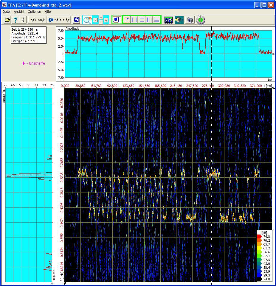 Funkeinzelsignal,