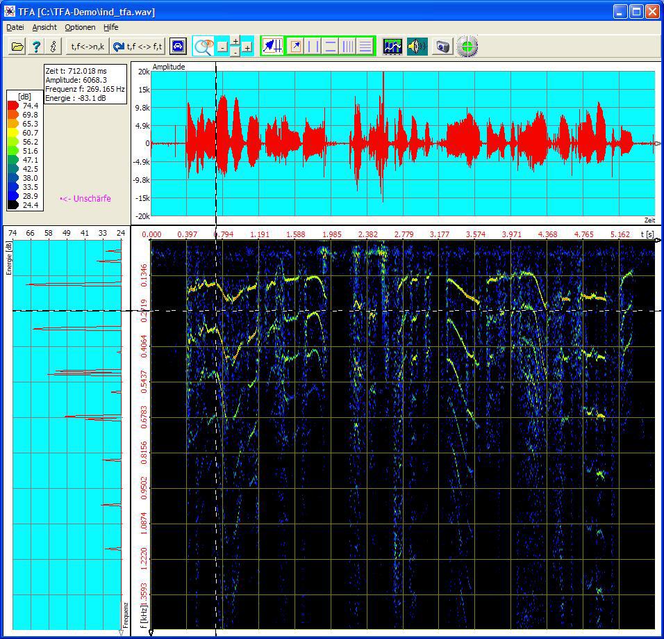 Sprachsignal,